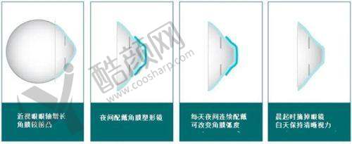 上海黑马眼科的服务保护