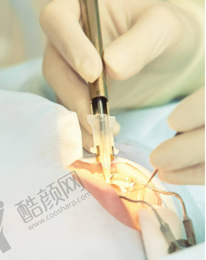 天津普瑞眼科医院技术高超,为视力保驾护航