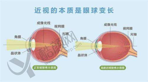 上海黑马眼科的价格优势