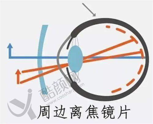 上海黑马眼科的技术实力特点
