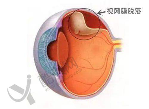 七、昆明景远眼科医院价格表：（仅供参考）