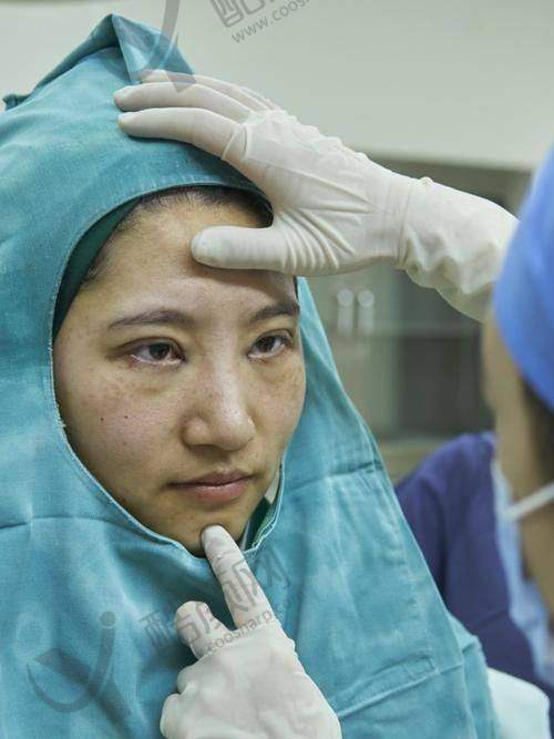 滕双燕眼部修复水平怎么样可靠吗？