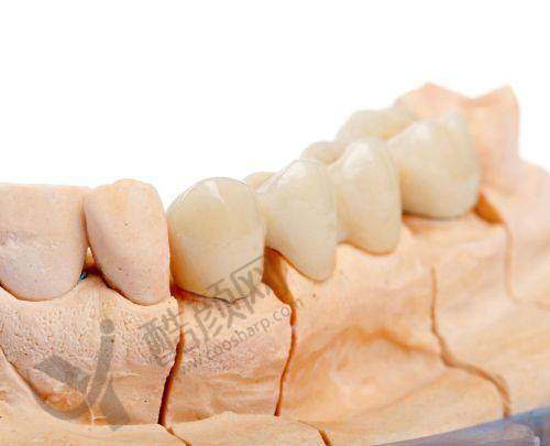 呼和浩特天牙口腔医院医生镶烤瓷牙价格800元起,邀名医交流保障镶牙高品质