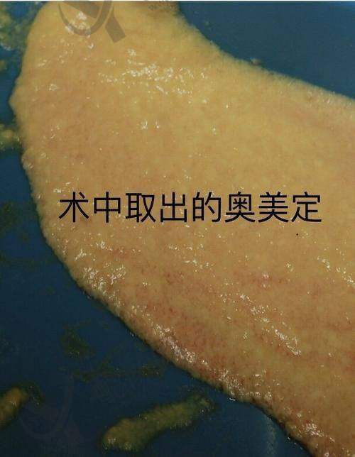 深圳曹孟君医疗美容：医生经验足成效好