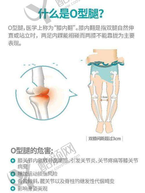 西安西美医院做直腿术多少钱？价格大揭秘