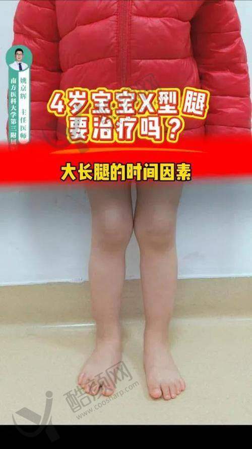 西安西美医院做直腿术医生推荐
