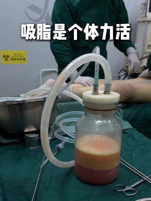 杨宇梓项目价格表参考