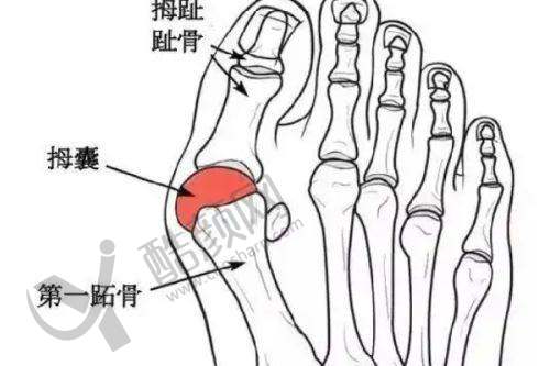 隆胸项目