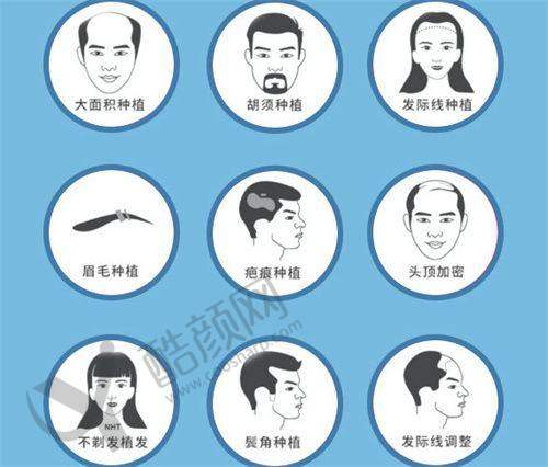 八、福州重森植发真实的顾客评价如下：