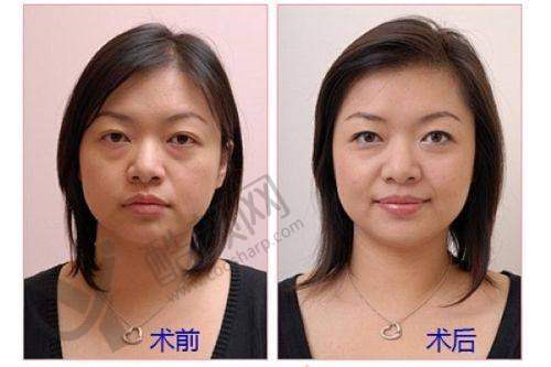 六、南京美伊成医疗美容诊所怎么预约：