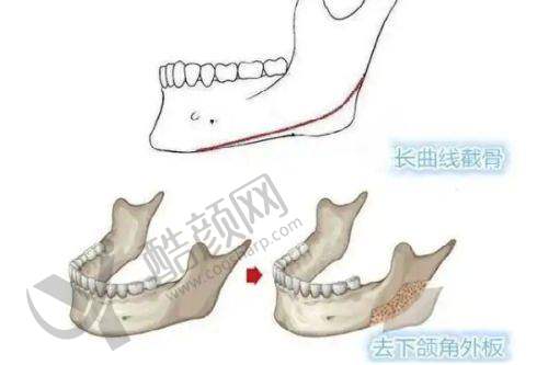二、哈尔滨羽禅医疗美容门诊部正规吗？来看看医院资质：