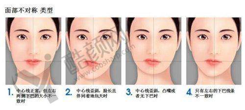 八、南京美伊成医疗美容诊所真实的顾客评价如下：
