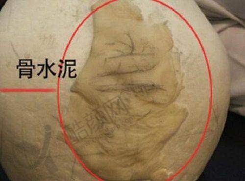 消费者的反馈