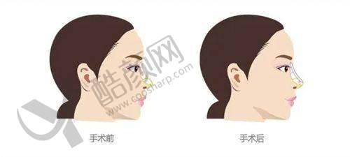 一、南通悦尔美医疗美容门诊部怎么样？