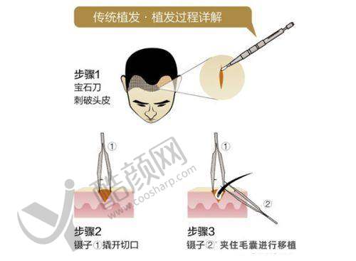 五、福州重森植发基本信息：