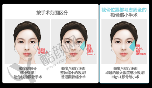 广州华美整形医院口碑怎么样?