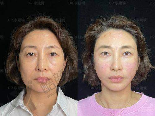 六、北京丽都素慕医疗美容诊所价格表：（仅供参考）