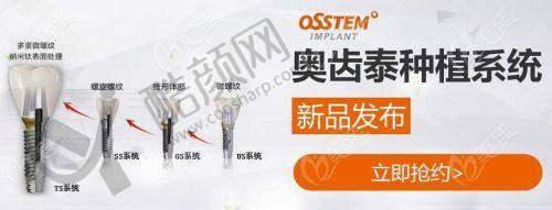 曲靖诺贝尔口腔王志瀚医生做奥齿泰种植牙2580元起,数字化技术护航种牙无忧