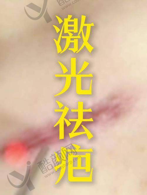 上海宏康医院治疗胎记疤痕怎么样?二级医院实力强,双医生护航分型分治!