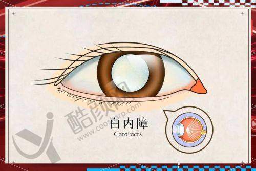 九江爱尔眼科医院地址与路线指引