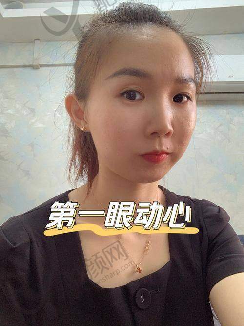 北京美莱李燕口碑评价