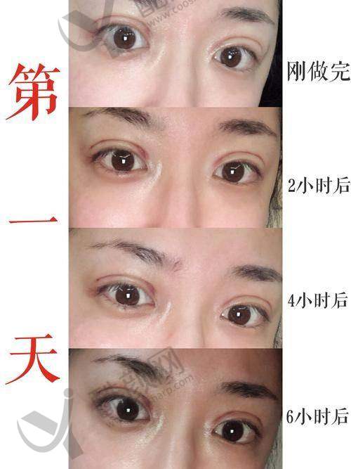 北京美莱李燕擅长项目