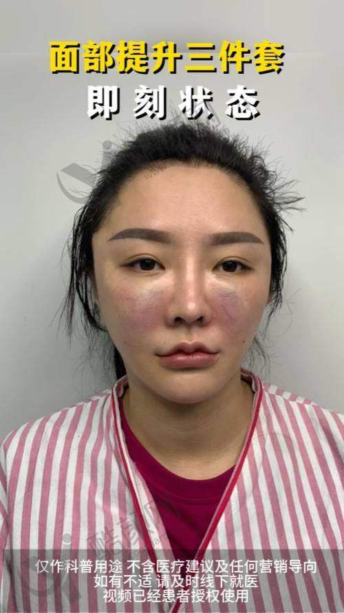 西安高一生整形医院：扎实技术与良好口碑的代表