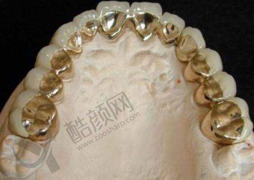 张家口麦格口腔钴铬合金烤瓷牙600元起,进口材料+微创技术,值得信赖