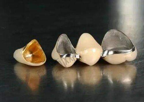 长沙牙祖口腔做全口义齿价格5260元起,正规分院多技术有保障