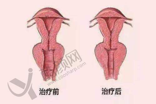 六、昆明医 科 大学第二附属医院医疗美容科怎么预约：