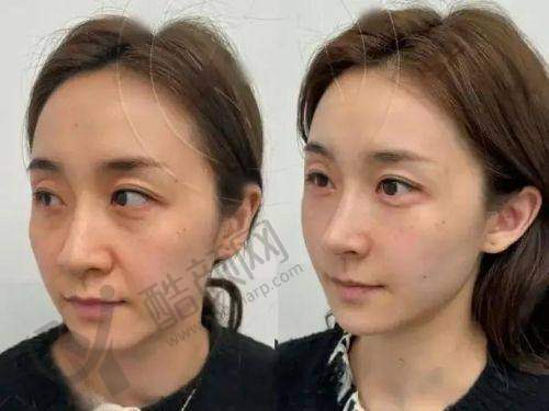 杭州艺星李俊霞口碑评价