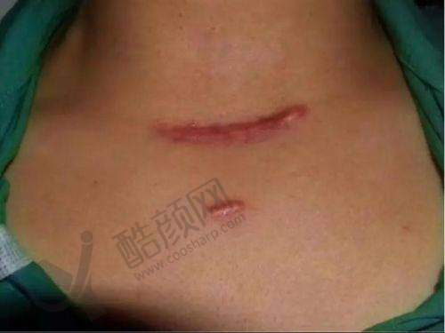 一、西安西交医院疤痕专科（陕西西交疤痕研究院）怎么样？