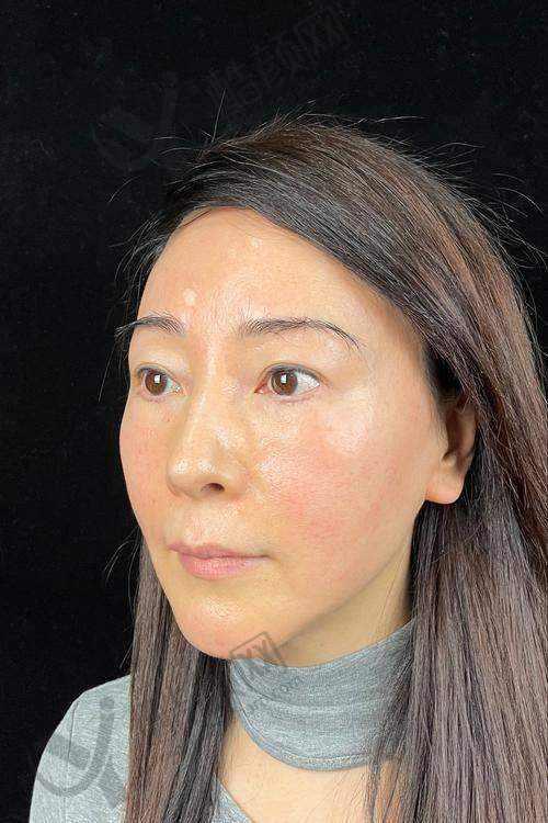 英伦大提升与超声炮：优势亮点大盘点，各有啥独特魅力？