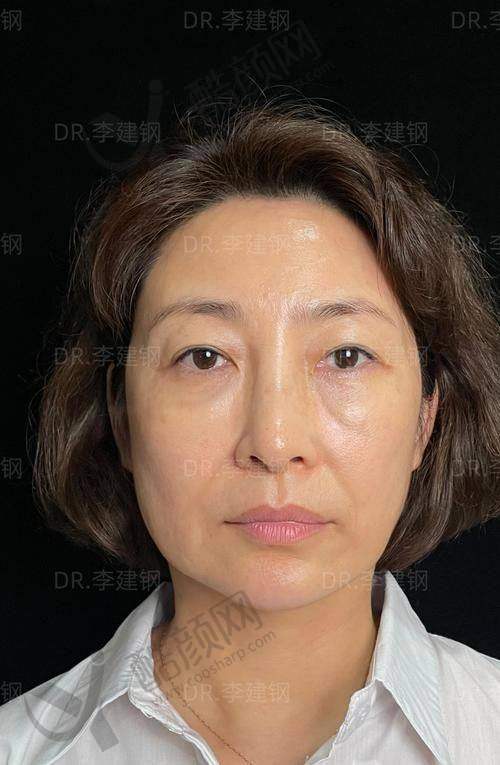 英伦大提升与超声炮：价格成本大分析，哪个更划算？