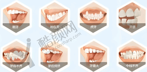 上海薇琳伯曼口腔医院肖求义医生做正雅隐形简单版矫正,价格12800元起,连锁口碑佳!