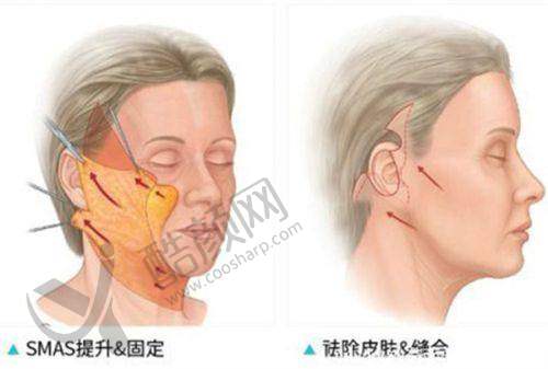 一、南阳市第三医院美容科怎么样？