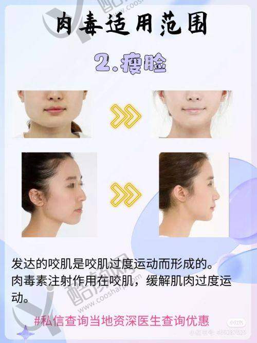 六、延安大学咸阳医院医疗美容科怎么预约：