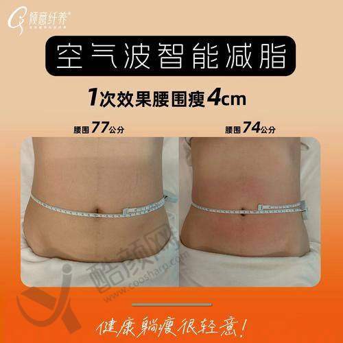 北京禾美嘉吸脂价格