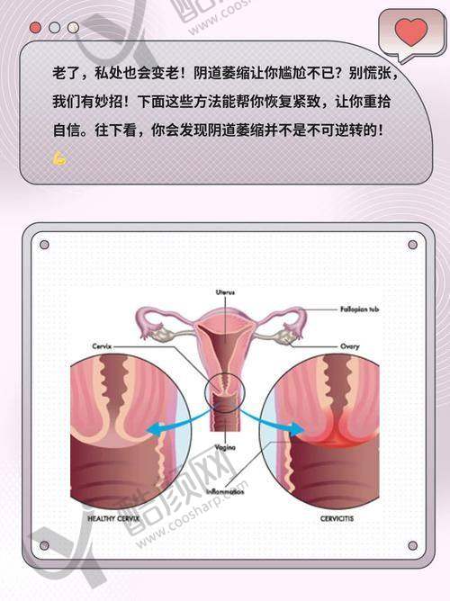 西安画美整形医疗医院——紧缩针优选之地