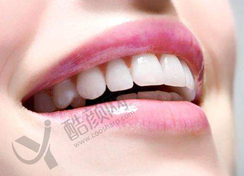 石家庄冀城口腔医院王哲鸣医生做全瓷牙冠价格1088元起,数字化诊疗更精准