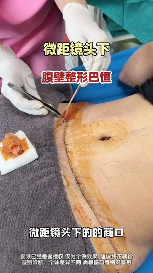 西安崔鑫在哪家医院