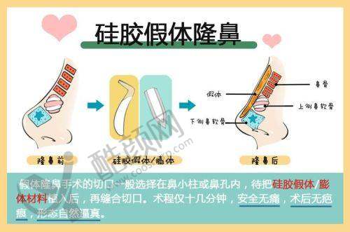 北京沃尔赵丹在哪家医院