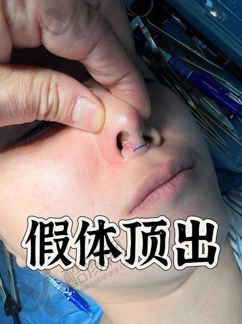 北京沃尔赵丹鼻修复水平怎么样可靠吗？
