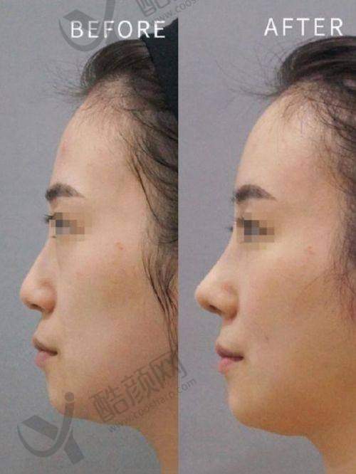 北京沃尔赵丹怎么预约？