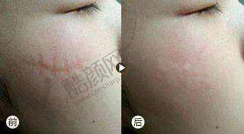 二、邵阳纤丽医疗美容门诊部正规吗？来看看医院资质：