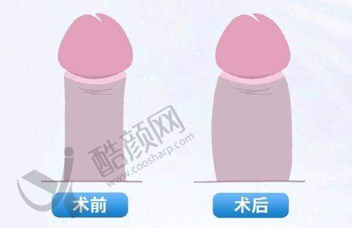 一、昆明医 科 大学第一附属医院医疗美容科怎么样？