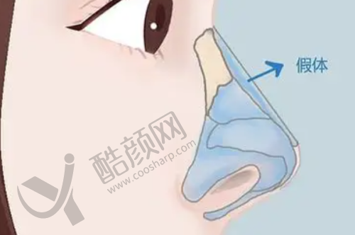 北京沃尔冯雁平口碑和评价