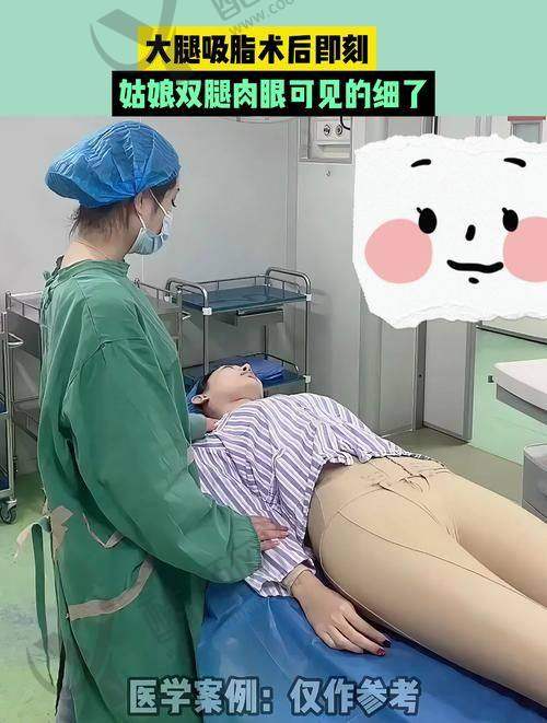 天津河西坤如玛丽医院吸脂(大腿/腰腹)项目真实评价