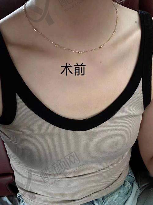 梁耀婵怎么预约？