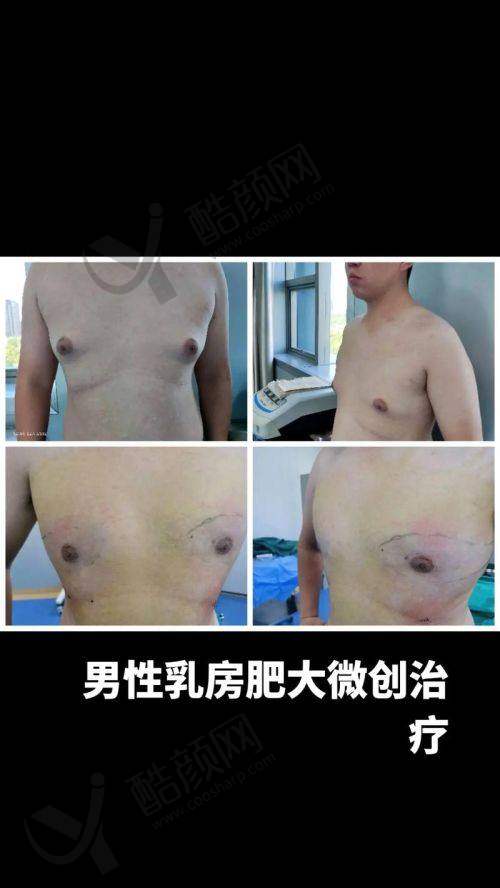 甘肃省人民医院：具有影响力可靠的医疗选择